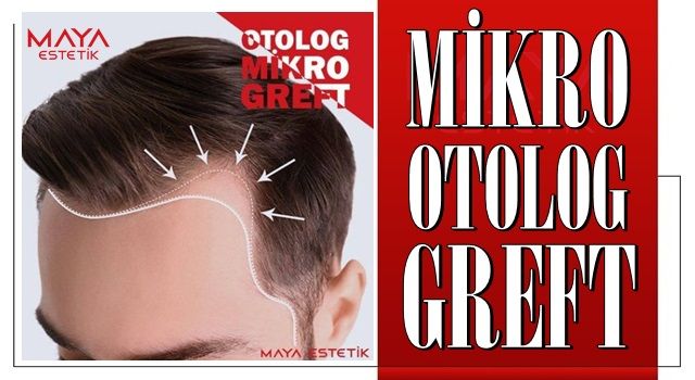 OTOLOG MİKRO GREFT