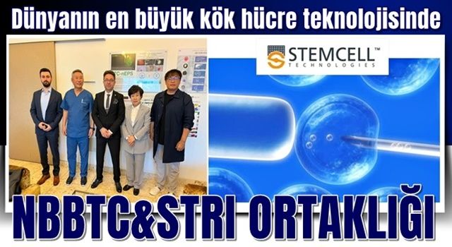 STRI Stem Cell ile NBBTC artık dünya devi olmak için birlikteler