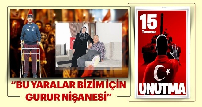 Bu yaralar gurur nişanemiz..