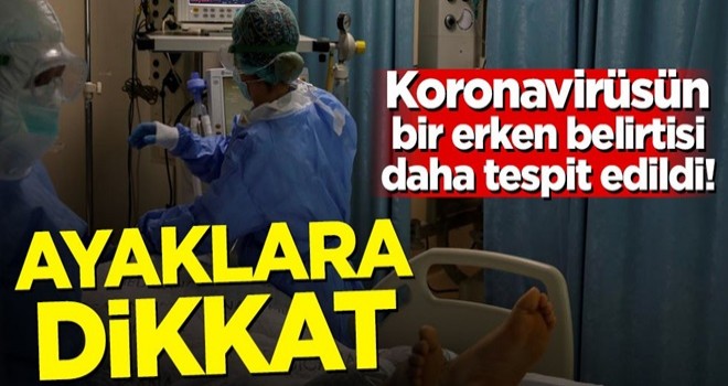 Koronavirüsün bir erken belirtisi daha tespit edildi! Ayaklara dikkat