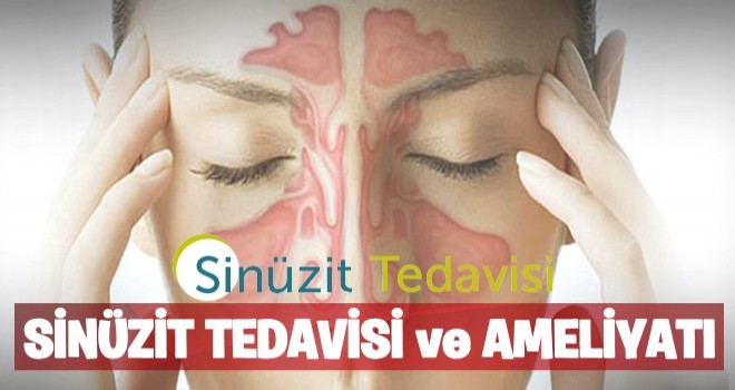 Sinüzit Tedavisi ve Sinüzit Ameliyatı